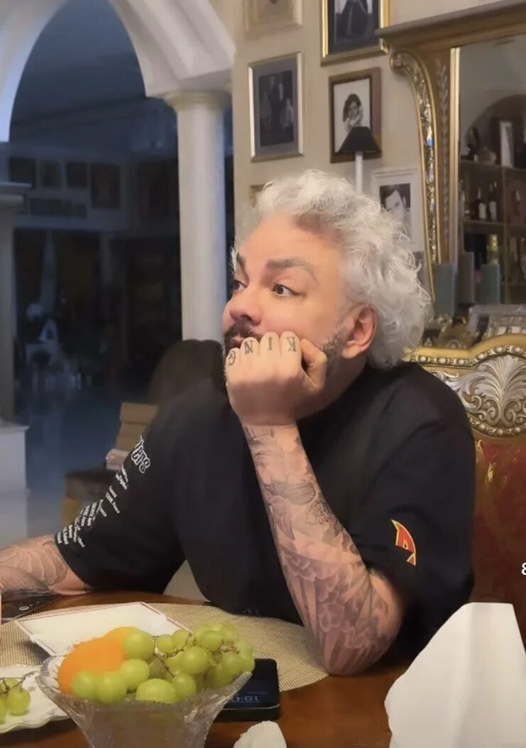 Киркоров планирует забить татуировками локоть, обгоревший на концерте в Петербурге